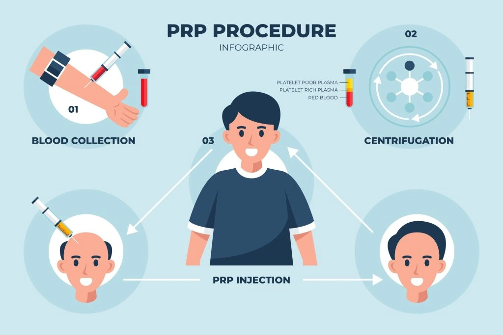 PRP Opinie: Sprawdziłam 20 Klinik w Warszawie - Oto Co Odkryłam